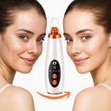 6 in 1 Multi-function Blackhead Remover Tools